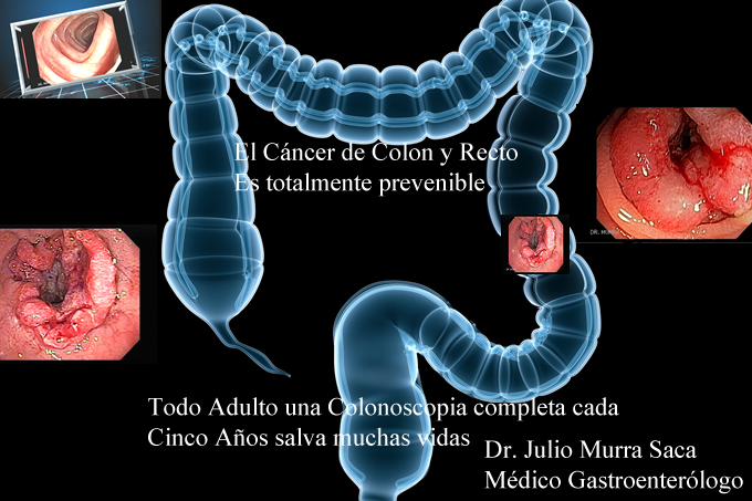 Gastroenterologo Salvadoreño